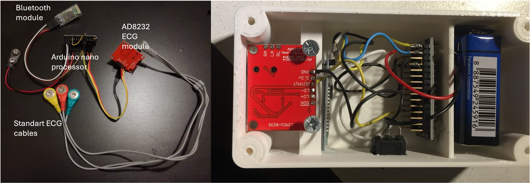 Bluetooth modülü, Arduino Nano, AD8232 EKG modülü, standart EKG kabloları ve kutu içine yerleştirilmiş cihaz örneği